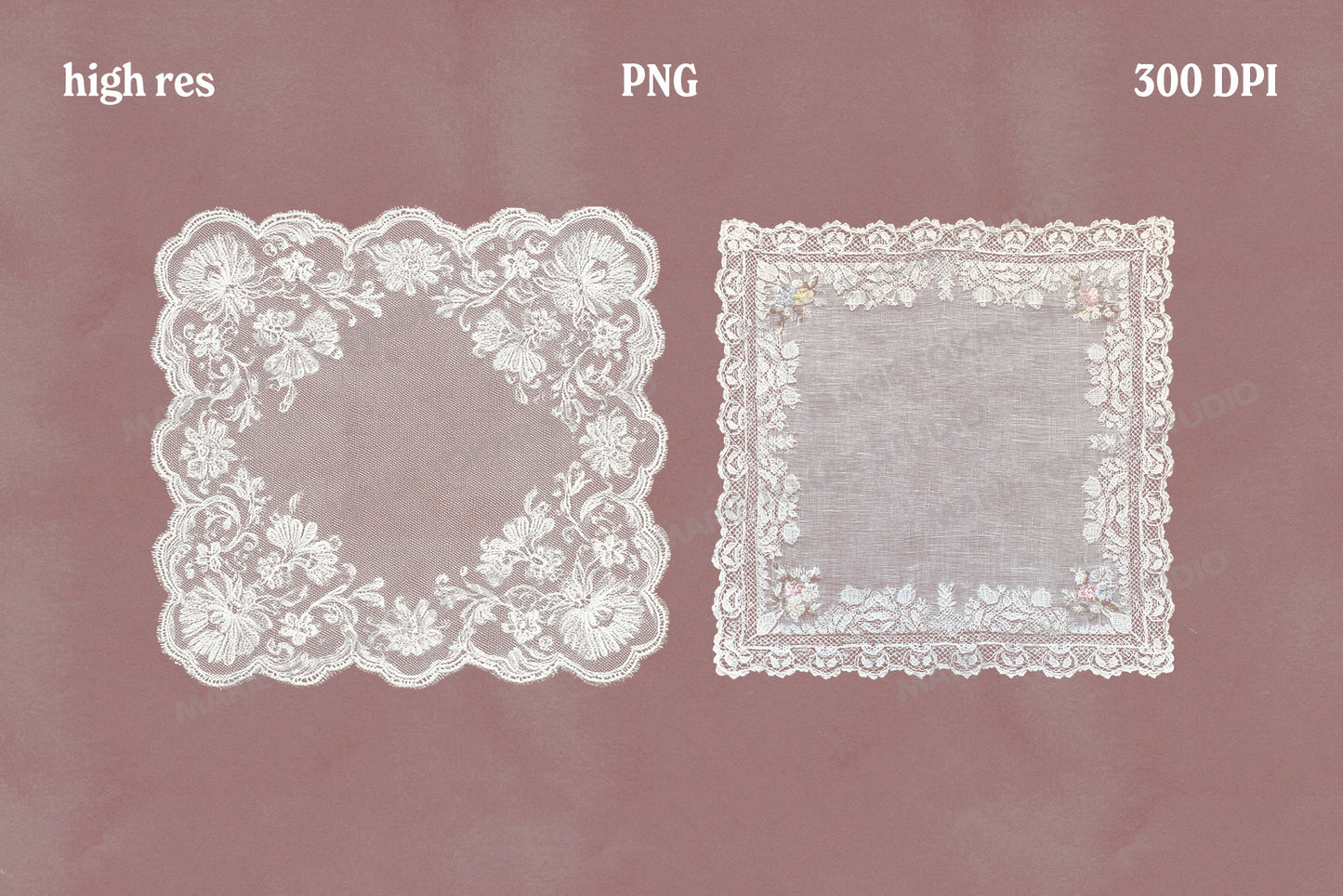 Vintage Lace Doilies Bundle