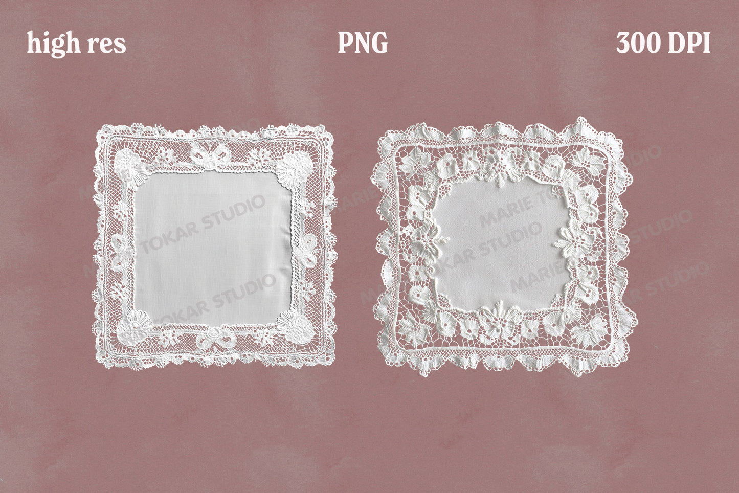 Vintage Lace Doilies Bundle